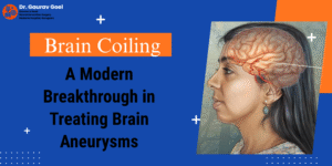Read more about the article Brain Coiling: A Modern Breakthrough in Treating Brain Aneurysms