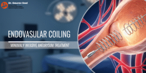 Read more about the article Endovascular​‍​‌‍​‍‌​‍​‌‍​‍‌ Coiling Treatment Doctor in Gurgaon: Advanced Care for Brain Aneurysms