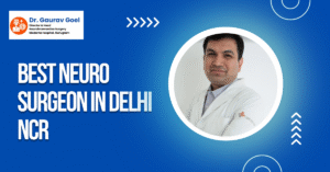 Read more about the article Best Neuro Surgeon in Delhi NCR – Dr. Gaurav Goel