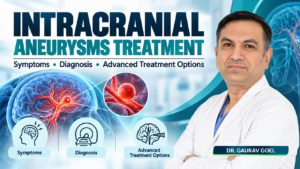 Read more about the article Intracranial Aneurysms Treatment: Symptoms, Diagnosis and Advanced Treatment Options