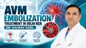 Read more about the article AVM Embolization Treatment in Delhi NCR — Dr. Gaurav Goel